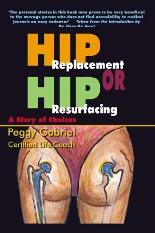 Peggy Gabriel/Hip Replacement or Hip Resurfacing@ A Story of Choices